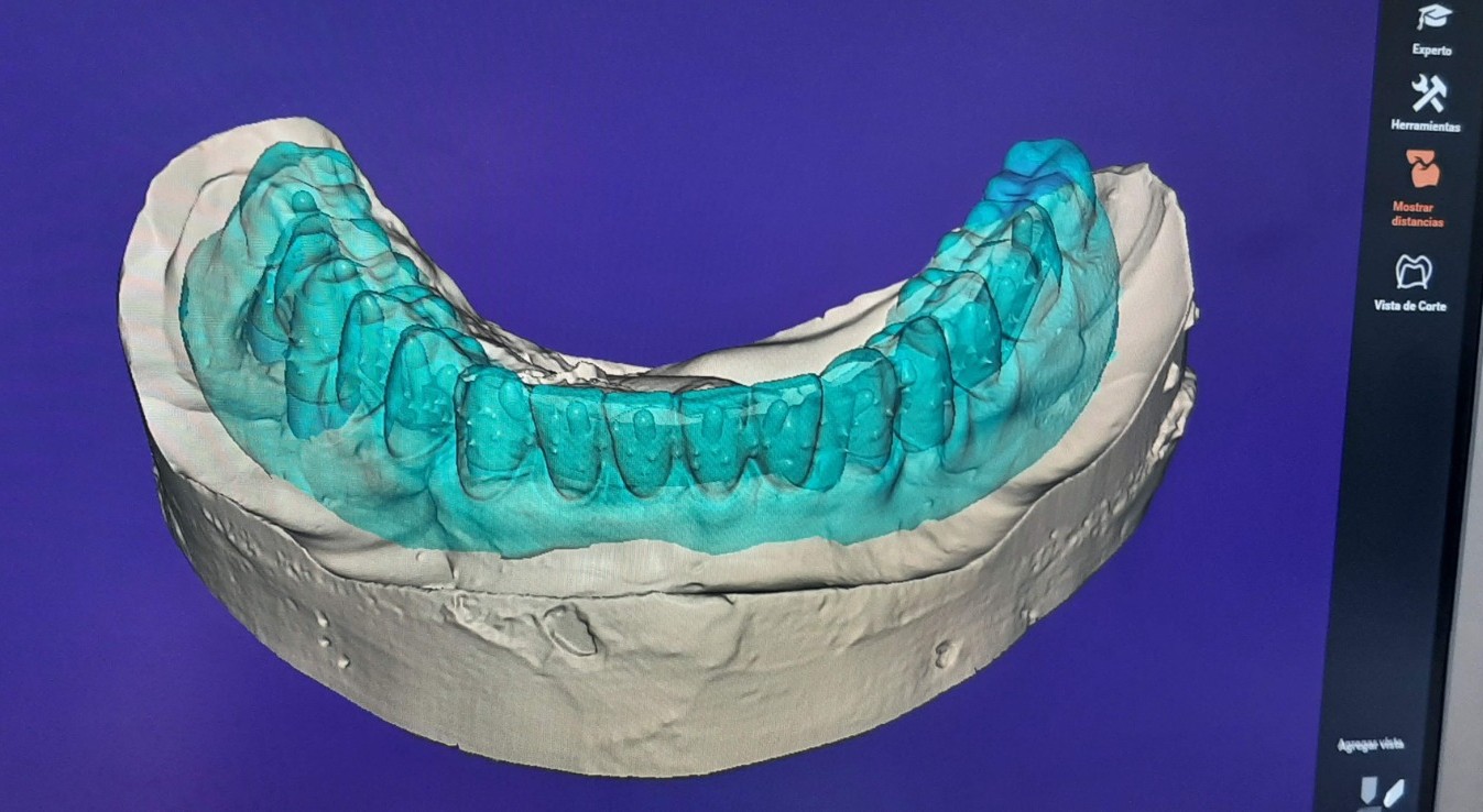 Tecnología CAD-CAM dental