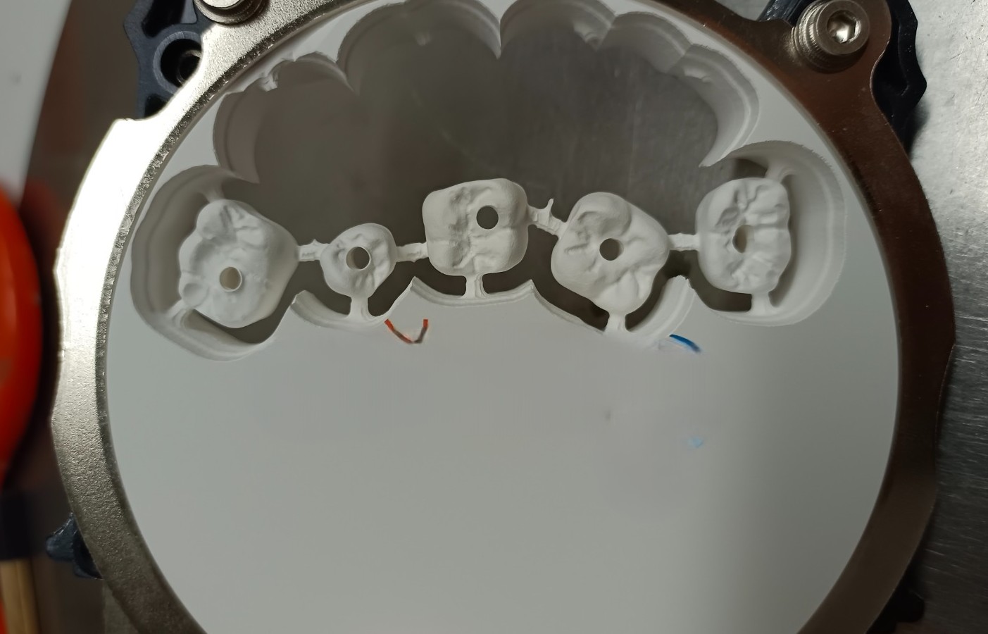 Tecnología CAD-CAM dental